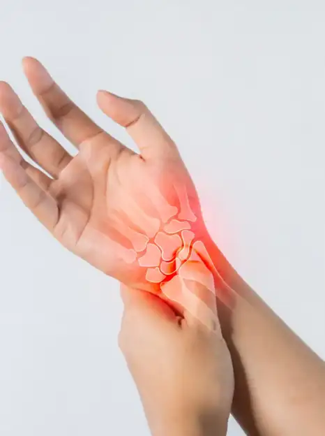 Carpal-Tunnel-Release-Thumbnail