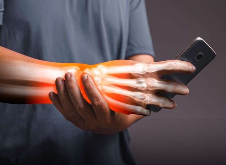 Carpal Tunnel Syndrome